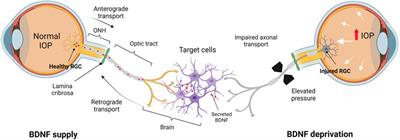 Brain-Derived Neurotrophic Factor-Mediated Neuroprotection in Glaucoma: A Review of Current State of the Art